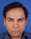 After Hair Transplant &nbsp;Front